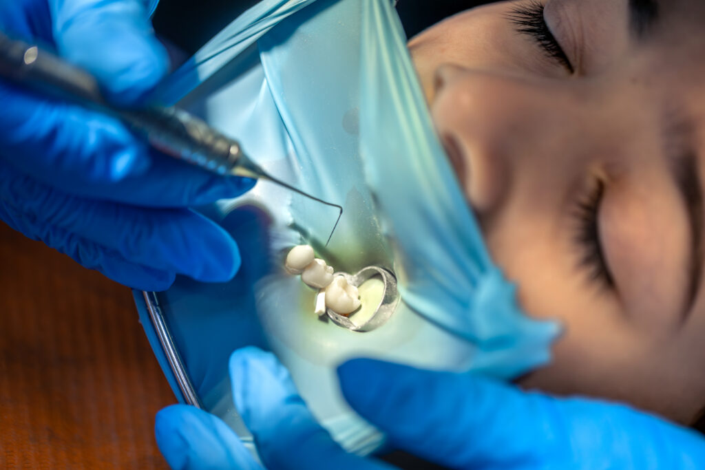 dentist treats childs tooth-using-rubber-dam installing filling tooth