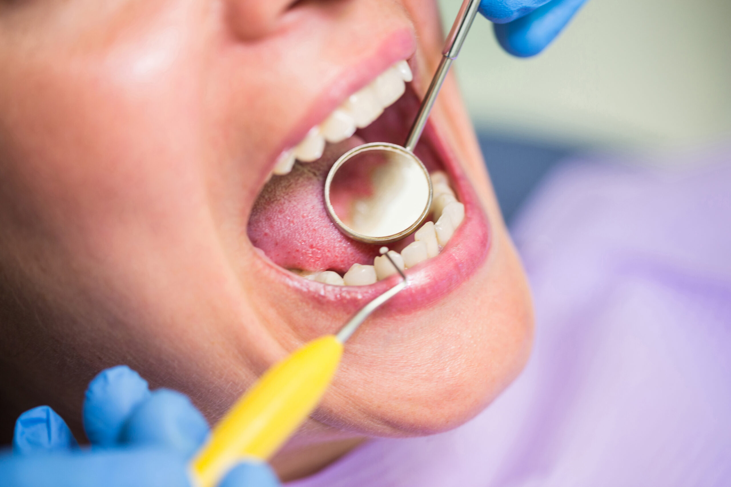 Crown Lengthening Procedure
